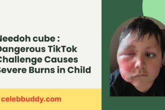 dangerous TikTok trend injury