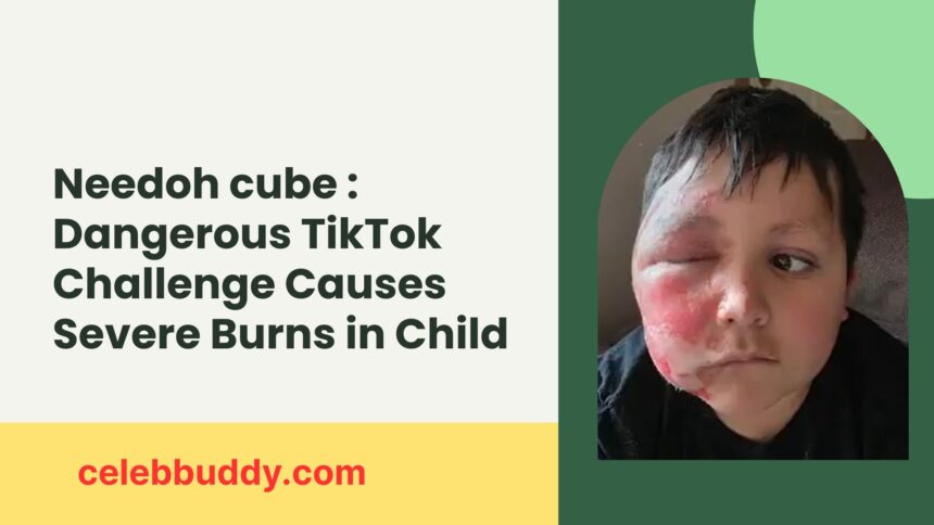 dangerous TikTok trend injury