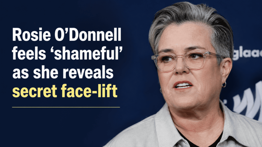 A side-by-side comparison of Rosie O'Donnell before and after her subtle lower deep plane face-lift, illustrating a slightly more rested and unbothered appearance.